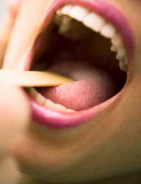 Lumps Throat Infection Hormones Thyroid
