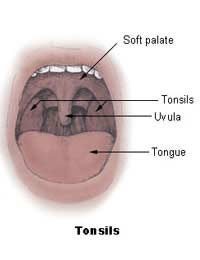 Tonsils Tonsillitis Immune System Glands
